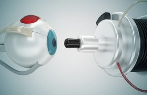 Laser e occhio