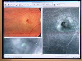 angiografia